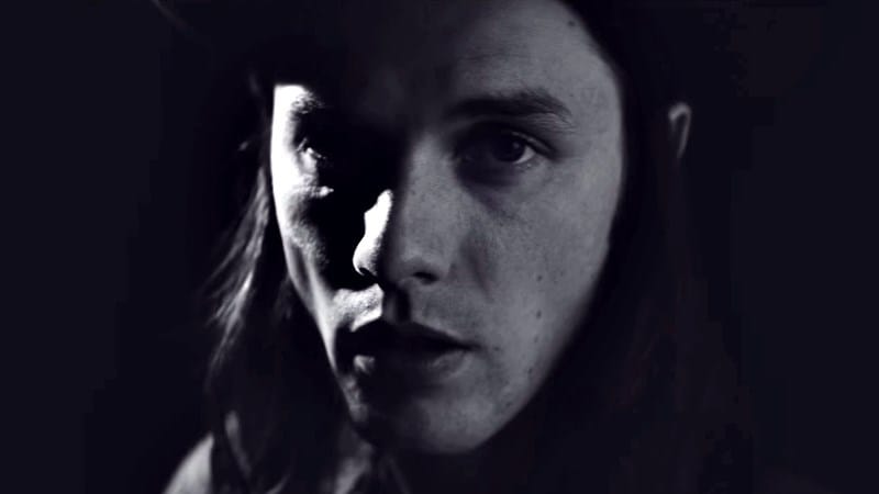 james-bay-scars