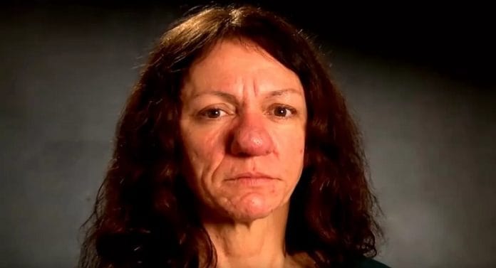 Pamela Évekig szenvedett az orra miatt, végül elment orvoshoz: nem győzünk gyönyörködni benne