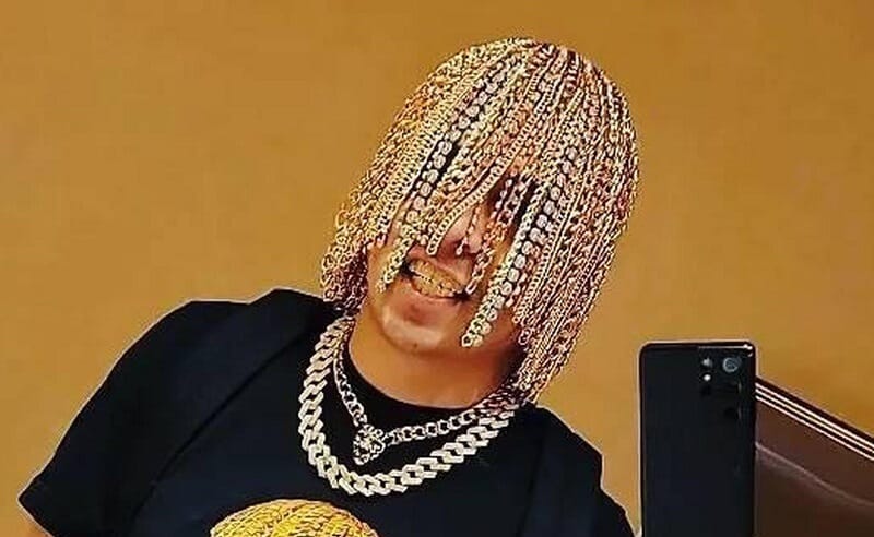 Dan Sur a világon az első rapper, aki aranylánc-implantátumot kapott a haja helyett!