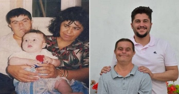 “Egy Down-szindrómás apa nevelt fel” - büszkén vállalja édesapját a fiatal fogorvos